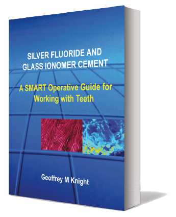 SMART Operative Guide for Working with Teeth